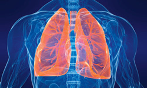 Ventilator associated pneumonia