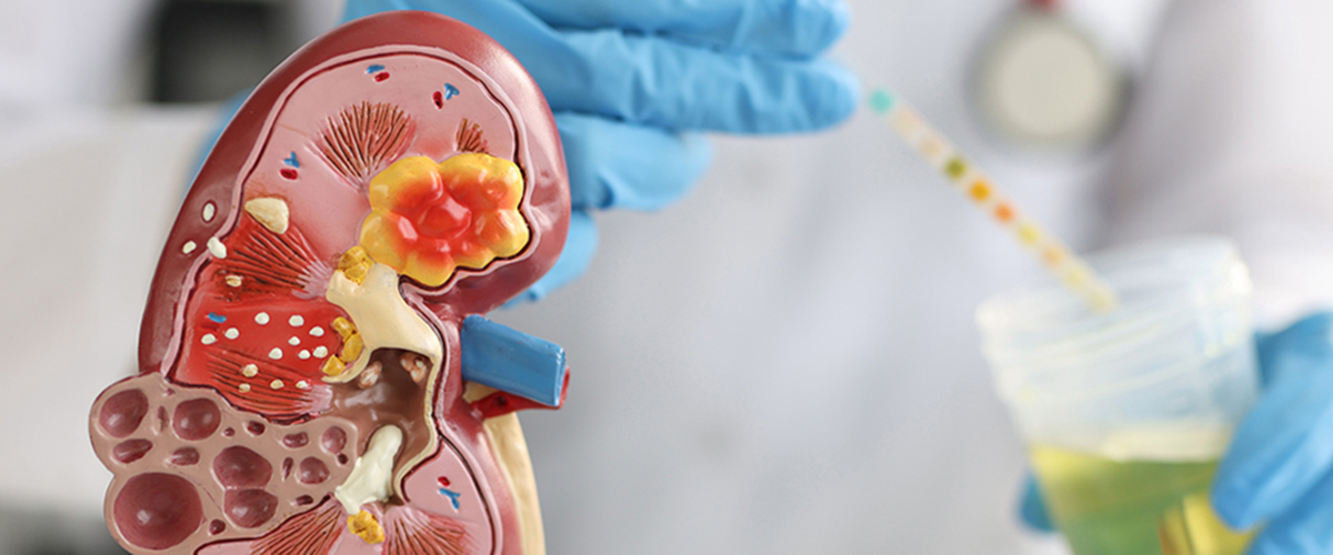 Urological Solutions Urological Solutions