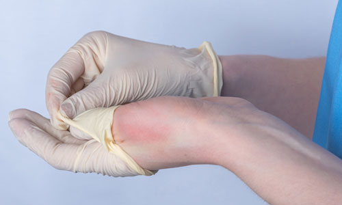 Occupational Skin Conditions in Healthcare: Impact and Prevention